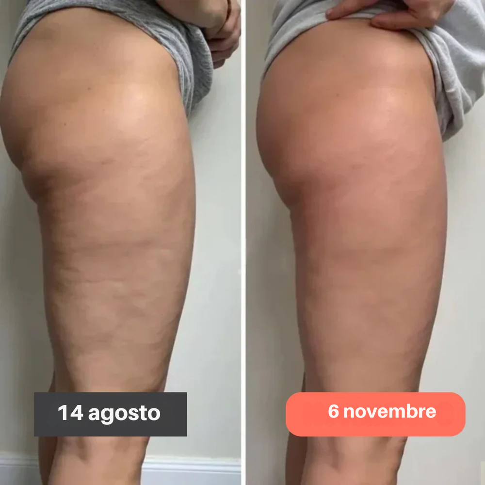 Leggings 3D FittaBella – Ridefinisci la tua silhouette senza sforzo